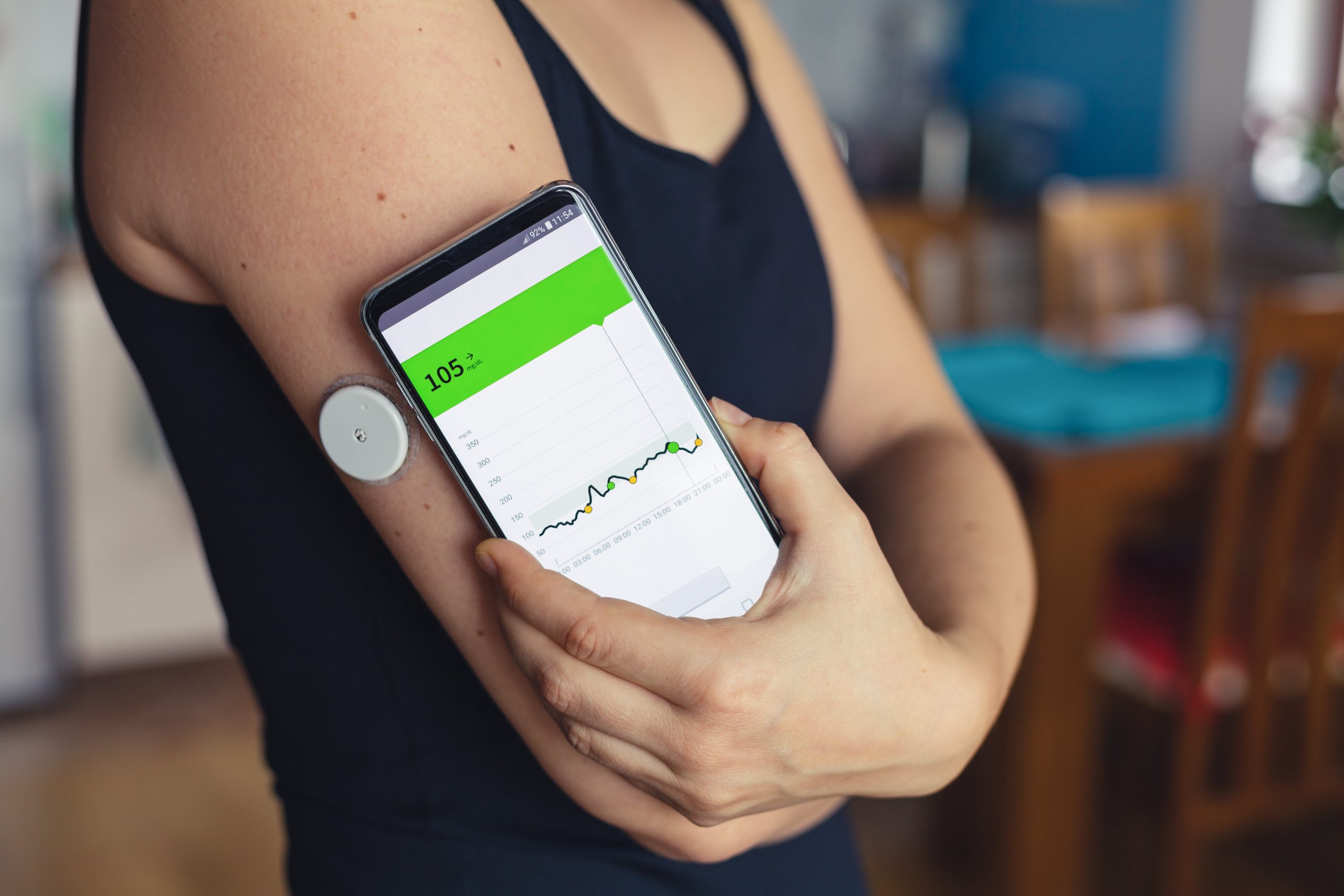 Continuous Glucose Monitoring (CGM)