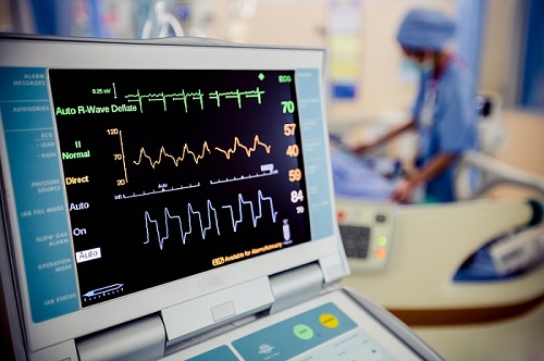 Electrocardiogram (ECG) Machines