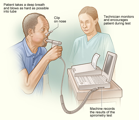 Spirometers