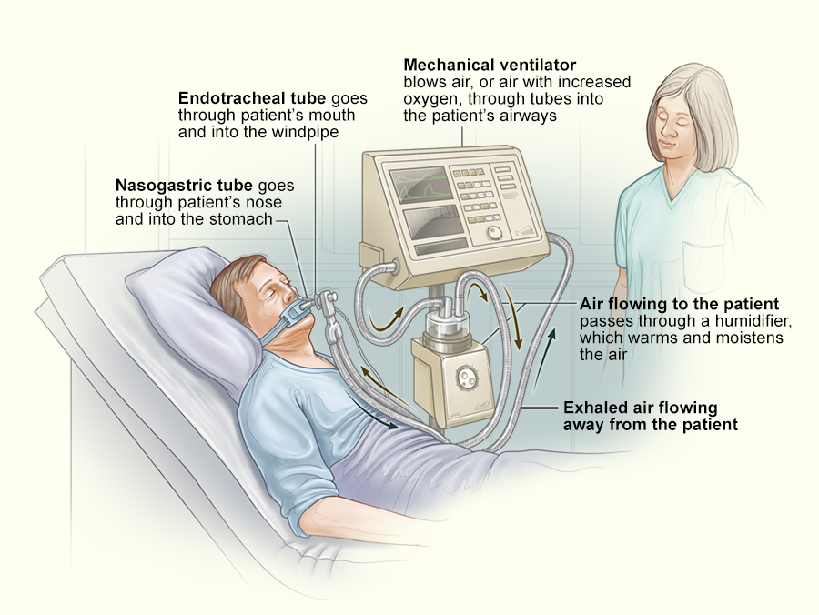 Ventilators and Respiratory Support