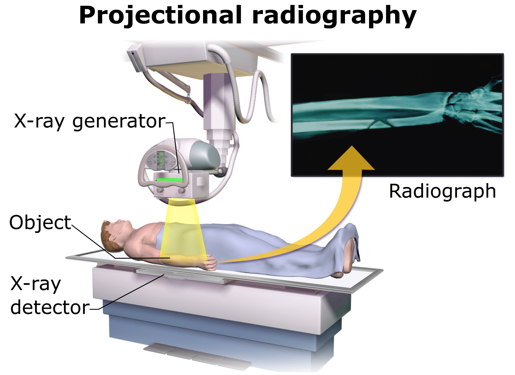 X-ray Machines and Radiography